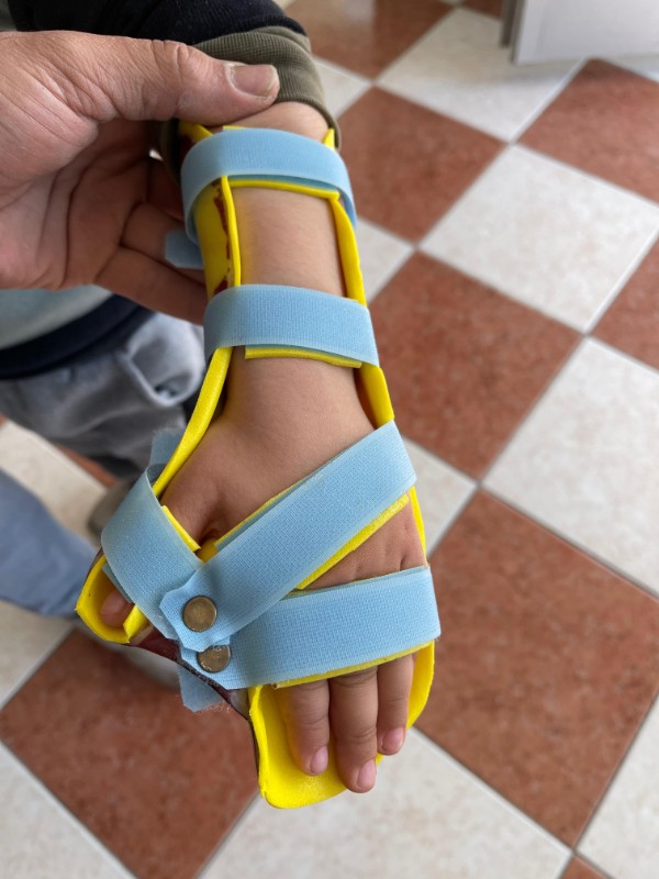El Splinti