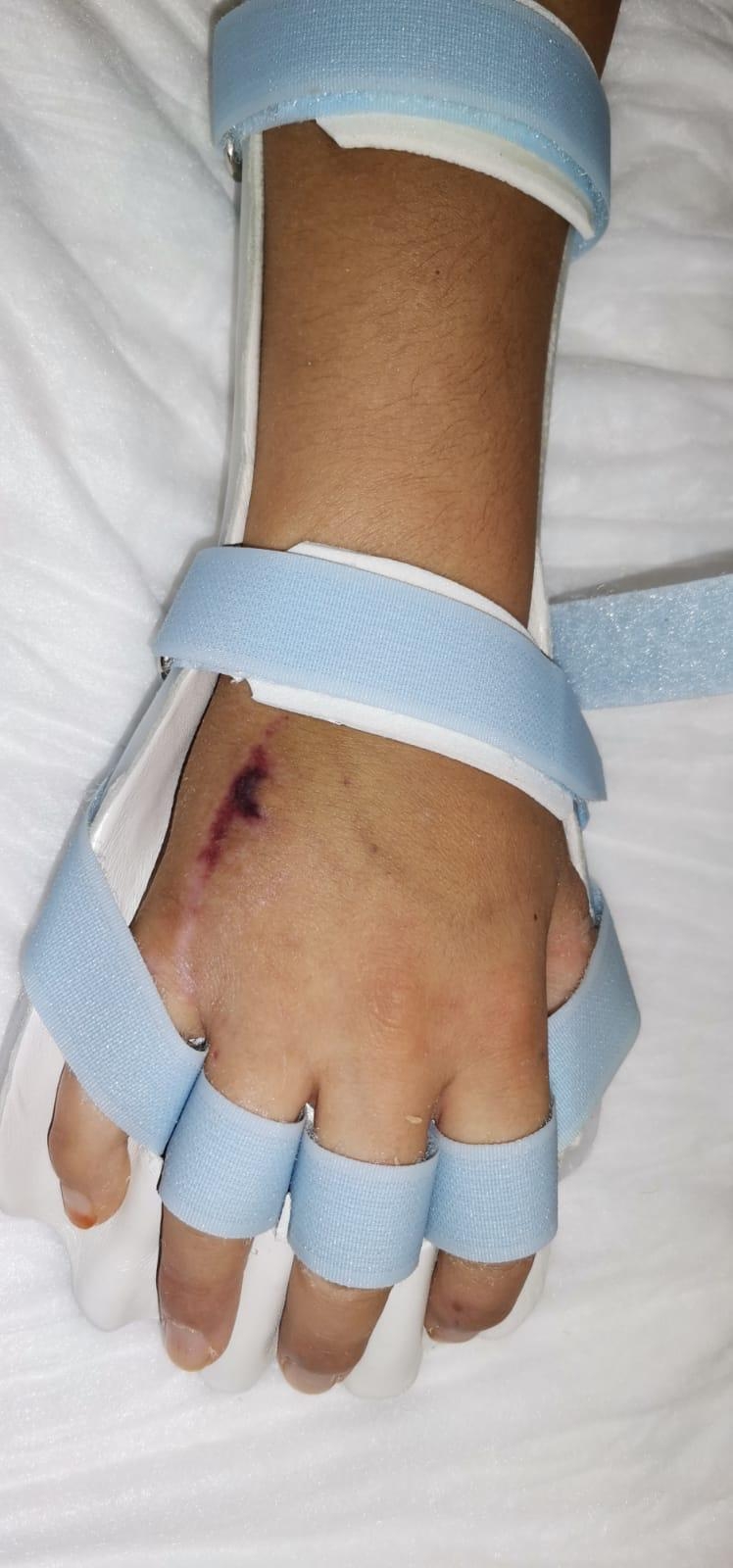 El-Bilek Splinti